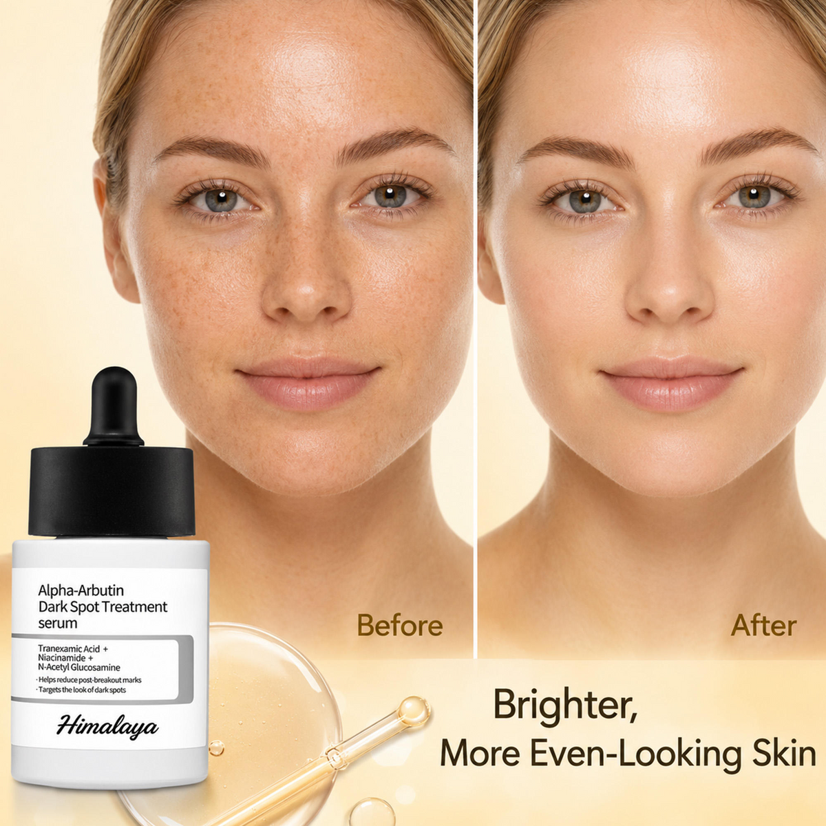 Alpha Arbutin Brightening Serum – Niacinamide & Glutathione